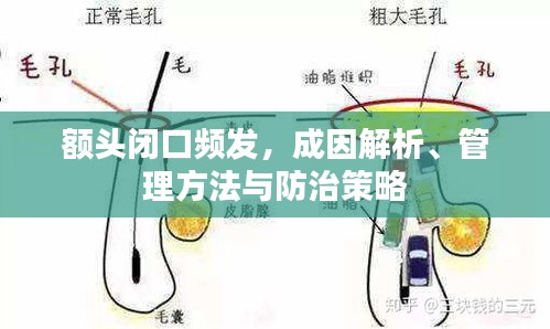 額頭閉口頻發(fā)，成因解析、管理方法與防治策略